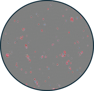 Microscopic image of T cells with fluorescent markers, viewed under dark gray background.