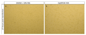 Comparison of HEK-293T cell morphology 27 hours post-transfection in DMEM + 10% FBS (left) and OptiPEAK HEK serum-free medium (right).