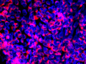 Fluorescence microscopy image showing bovine viral diarrhea virus–associated signal in infected cell culture.