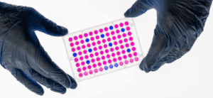 Hands holding a 96-well microplate with colorimetric results from a laboratory assay.
